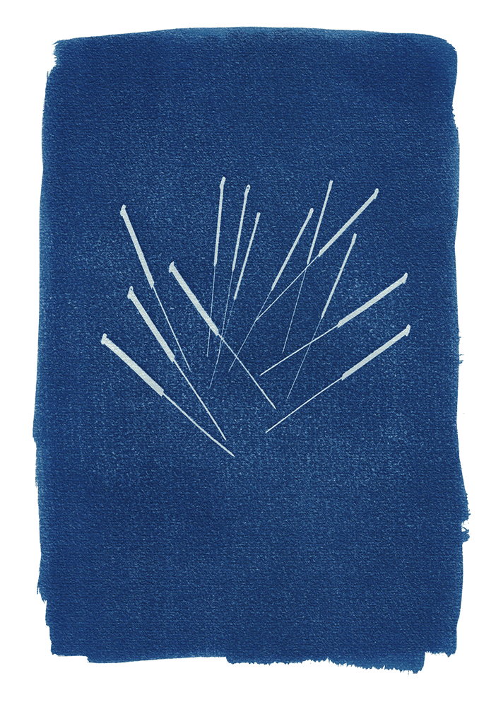 acupuncture cabinet médecine chinoise soin énergétique énergie massage santé bien-être approche holistique intégratif sion valais suisse